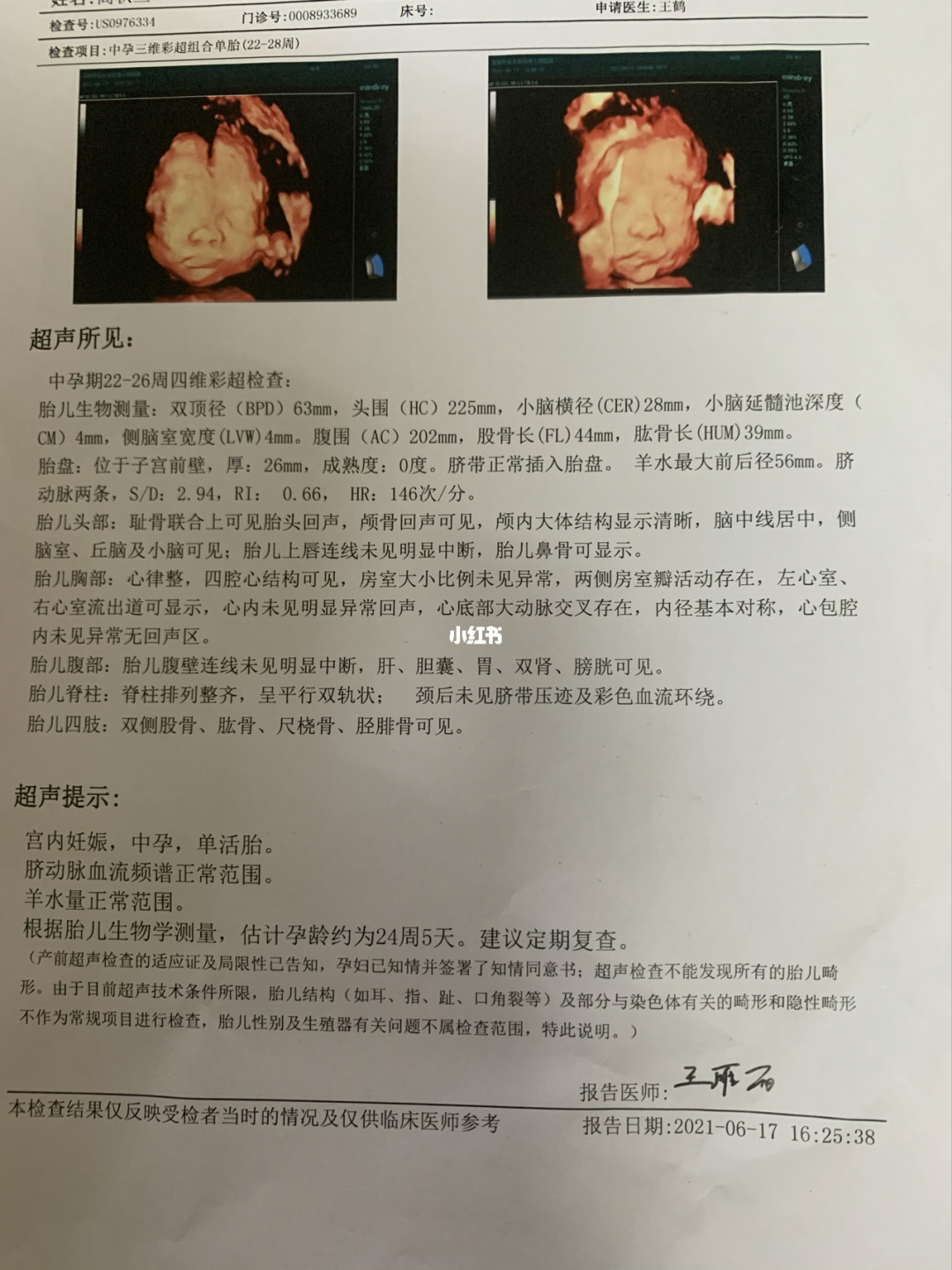 教你一分钟看懂四维彩超单，生男生女早知道